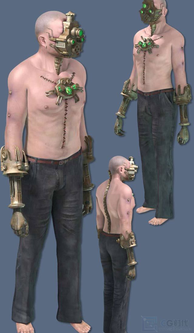 \