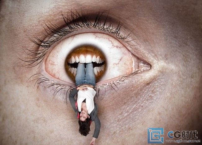 \