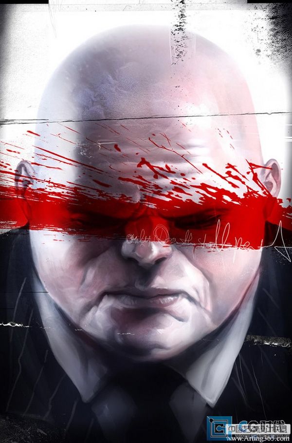 \