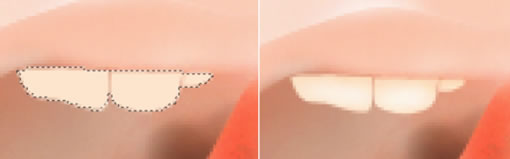 \