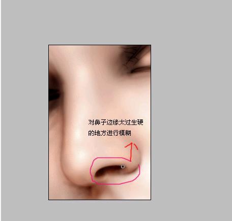 \