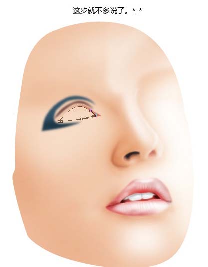 \