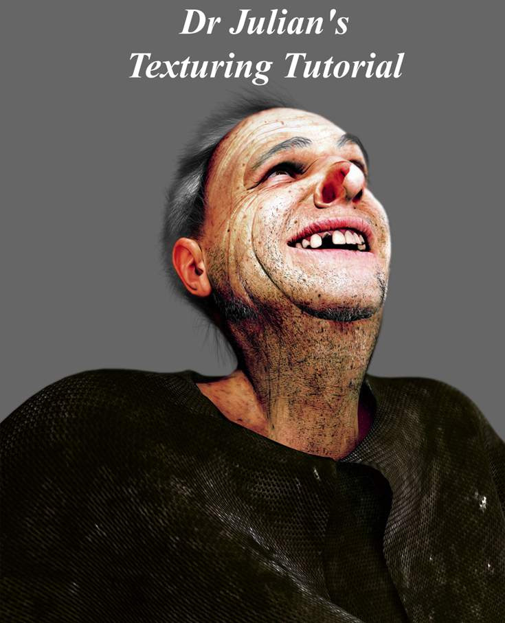 \