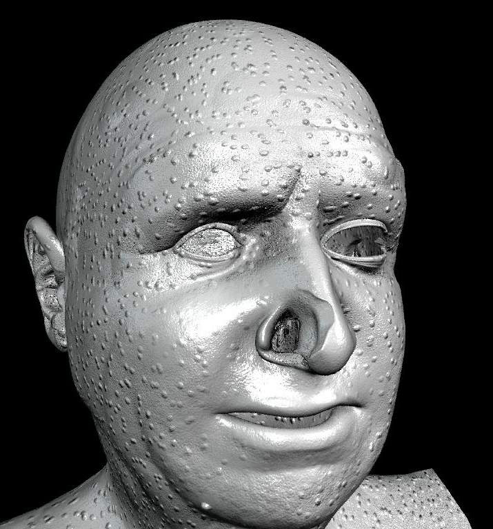 \