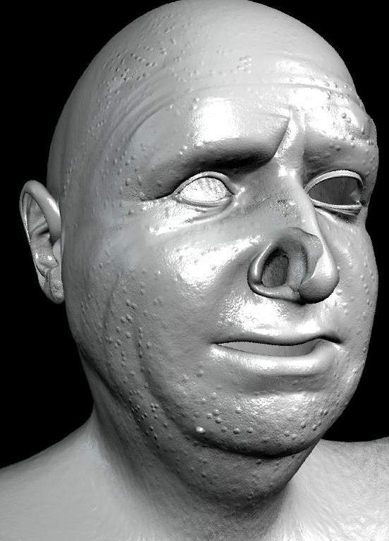 \