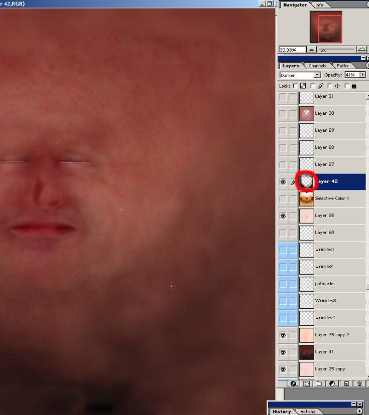 \