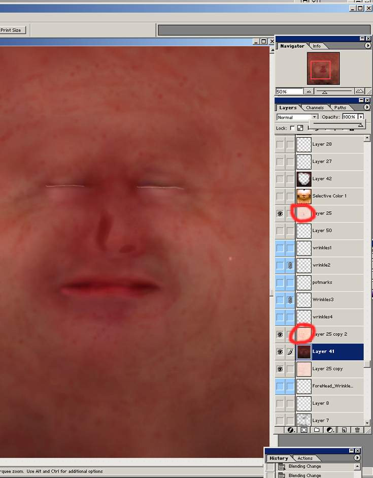 \