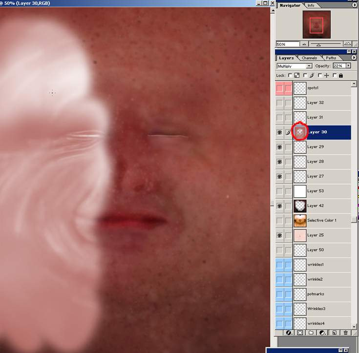 \