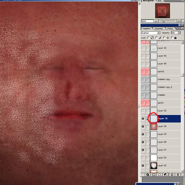 \