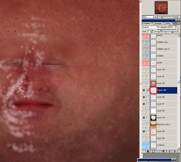\