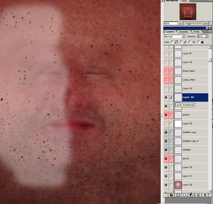 \
