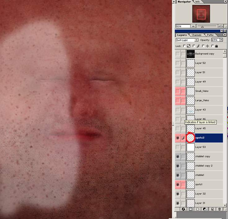 \