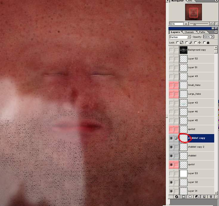 \