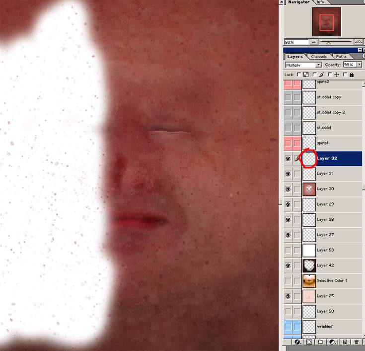 \