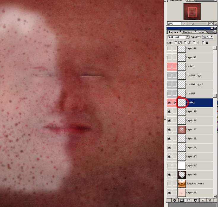 \