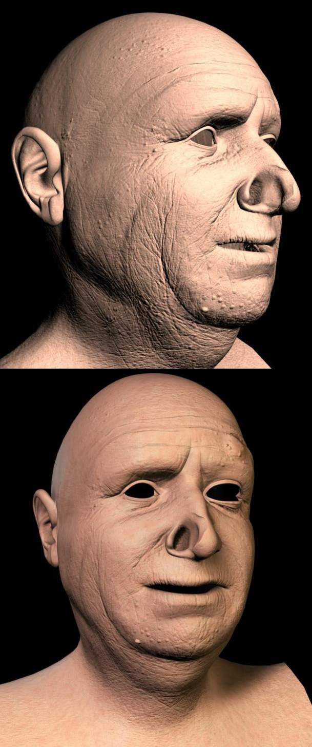 \