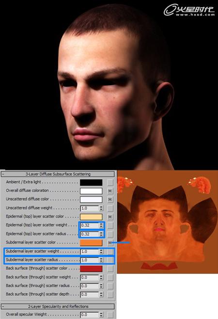 \
