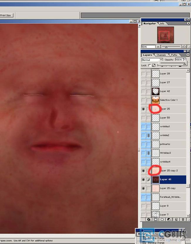 \