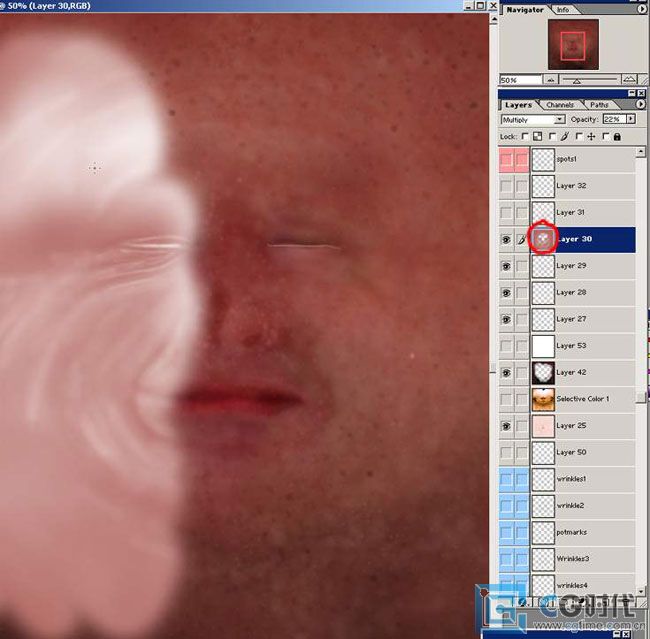 \