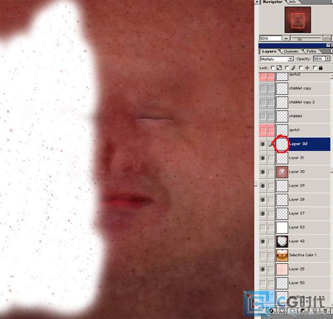 \