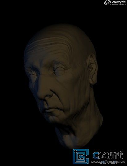 \