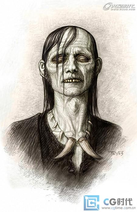 \