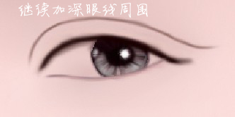 \