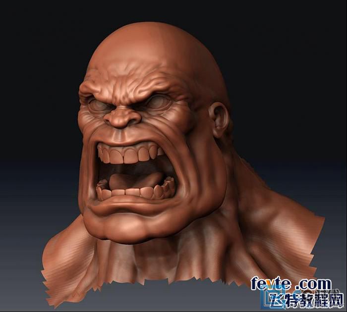 \