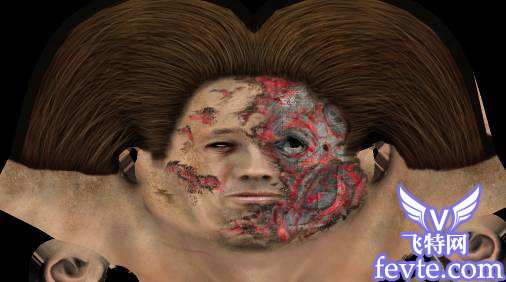 \